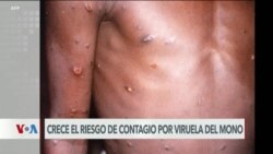 El Mundo al Día